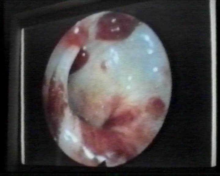 Music Video III Ding Tong (Aids Virus) 音樂錄像III:叮噹您之看見病毒看見您